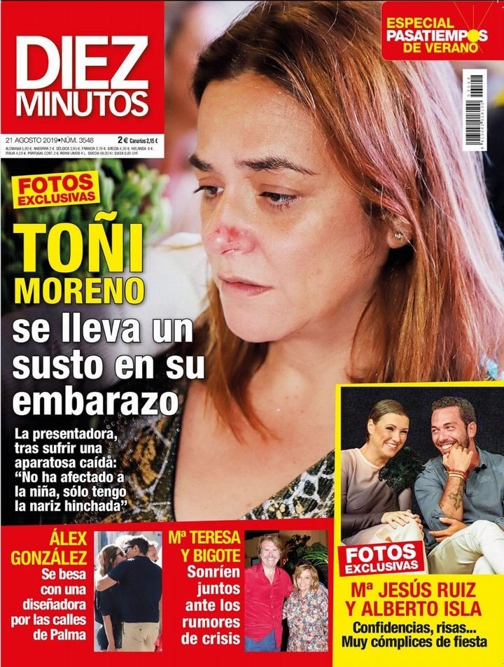 DIEZ MINUTOS Así quedó Toñi Moreno tras caer de bruces