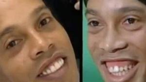 Ronaldinho se gasta 50.000 euros en operarse los dientes y tener una bonita sonrisa 